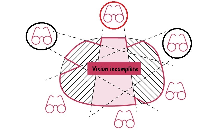 Vision incomplète